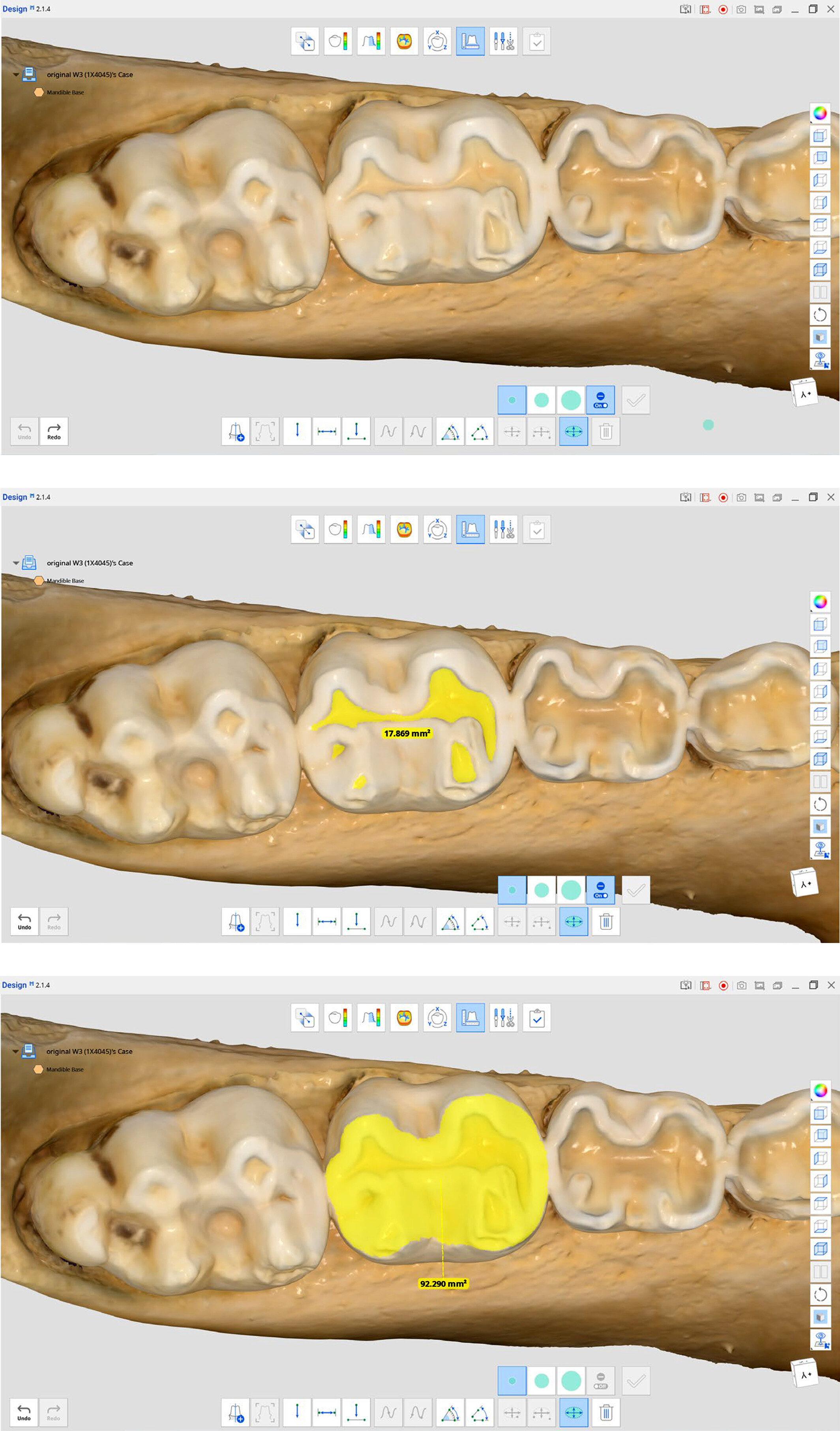 image of captive baboon teeth